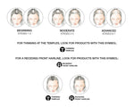 rw-transformations-hair-loss-stages-new